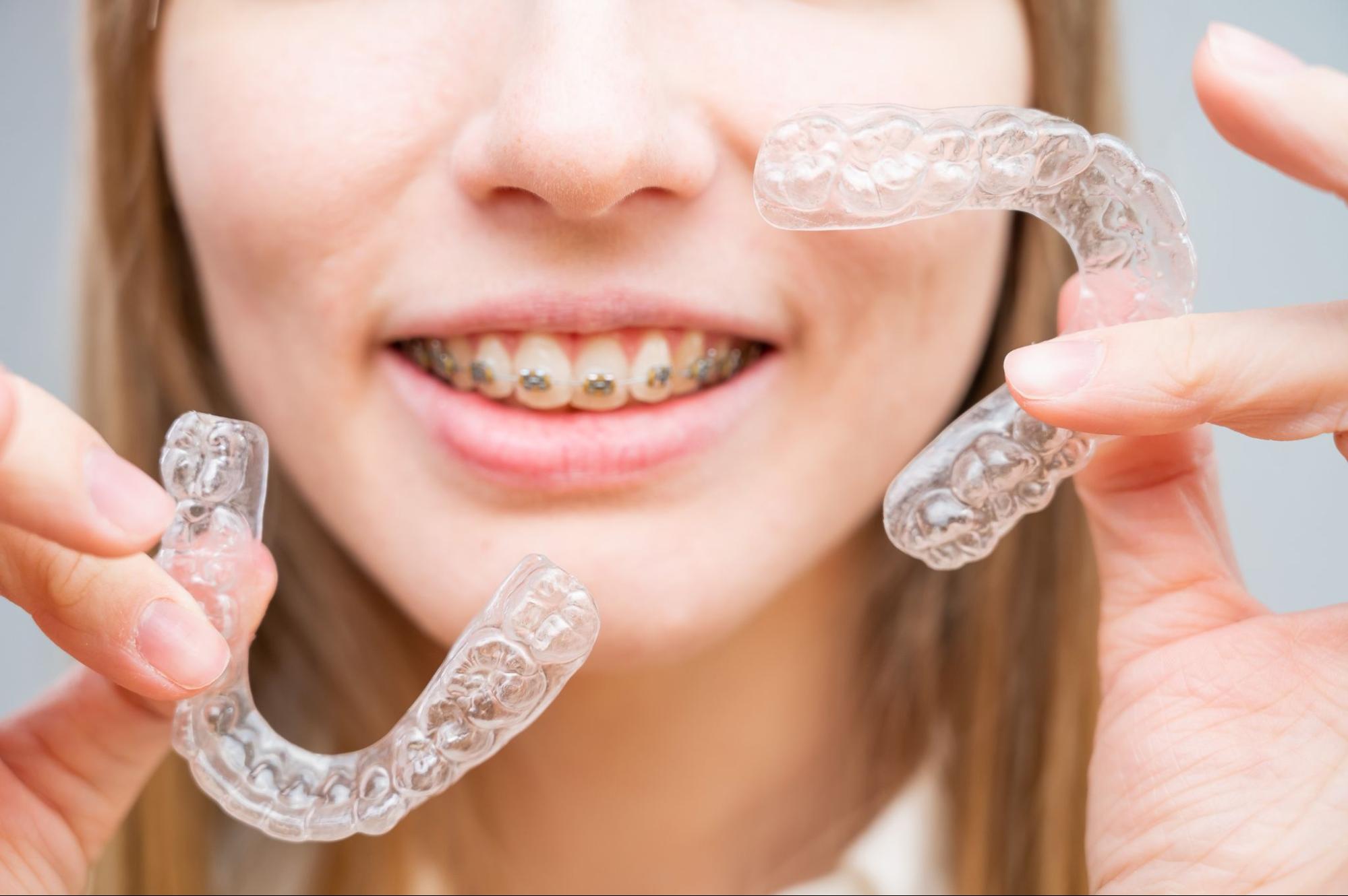 10 Braces and Aligner Tips for Everyday Success