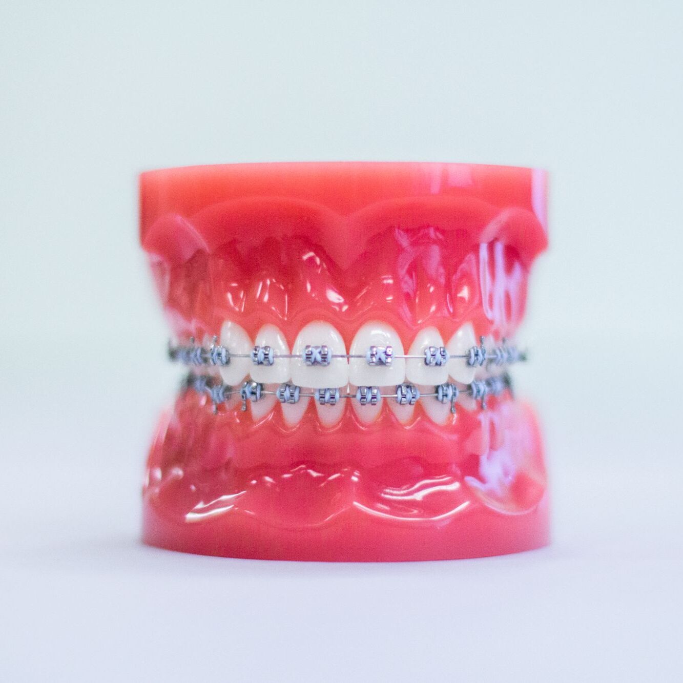 invisalign roy ut